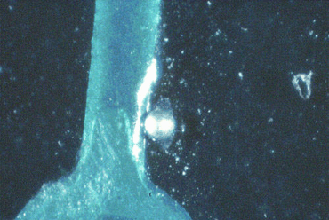 Figure 4: Solder on a resist can wet during wave contact and leave a ball